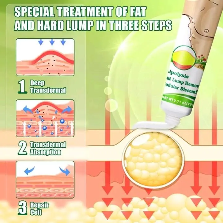 Sumifun Lipoma Cream 20gr / Salep Lipoma - Benjolan Herbal 1