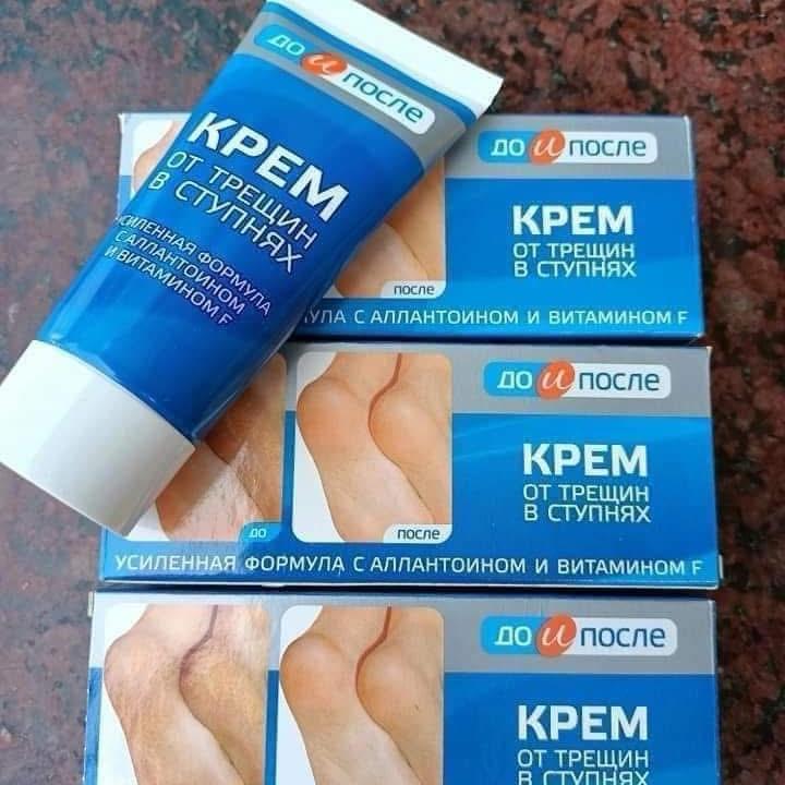 Kem bôi nứt , nẻ gót chân kpem hàng nga 50ml 4