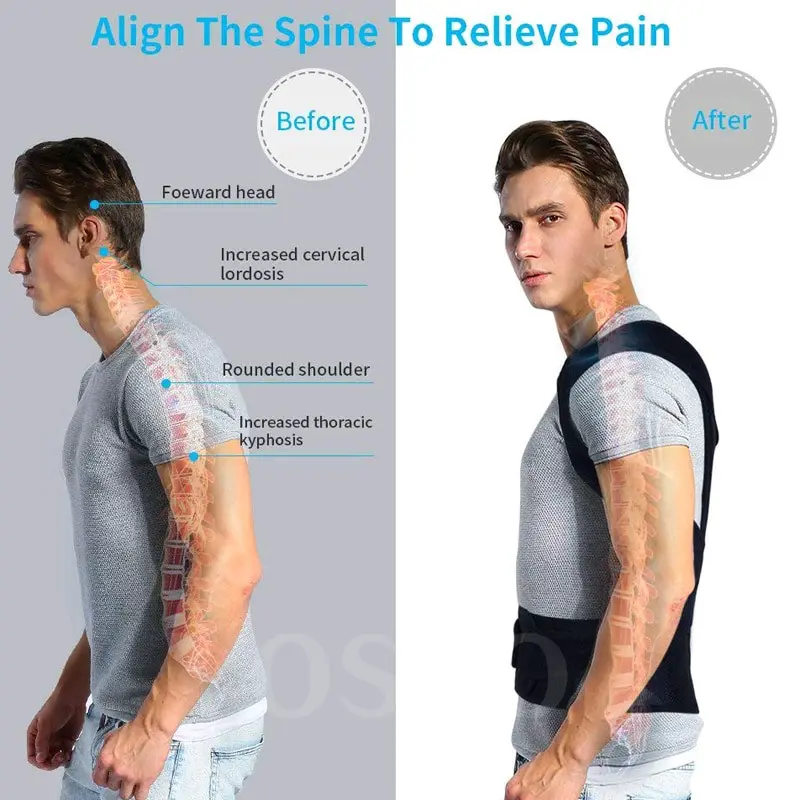 POSTURE CORRECTOR PENEGAK PUNGGUNG BUNGKUK PELURUS TULANG PUNGGUNG BELAKANG SKOLIOSIS KIFOSIS YOSYO
