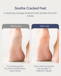 Gambar ENCHEN Rechargeable Foot Care Callus Remover Penghalus Kapalan Alat Pembersih Kaki Alat Manicure Pedicure dari PIK88ELEKTRONIK Kab. Tangerang 2 Tokopedia