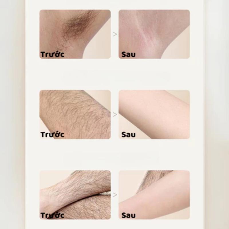 (COMBO 2) Kem Tẩy Lông OTOU Toàn Thân Nách, Tay 120G | Wax Lông An Toàn, Không Đau, Không Kích Ứng, Dành Cho Mọi Loại Da, Dùng Cho Cả Nam Và Nữ 9