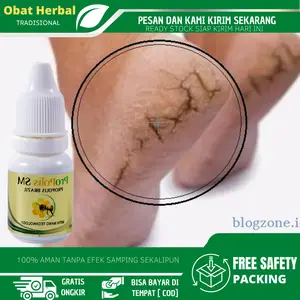 Cairan Oles Untuk Kaki Pecah Pecah, Tumit Kaki Kering Pecah Pecah, Menghaluskan dan Melembutkan Tumit Kaki Dengan Propolis sm