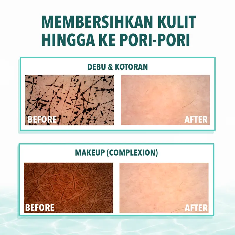 Emina Low pH Micellar Water Complete Series - Kering dan Kusam, Berminyak dan Berjerawat, Kulit Sensitif 125ml & 300ml | Pembersih Wajah Gentle Makeup Remover Double Cleansing Acne Skin Mencerahkan Menghaluskan Brightening Glowing 7