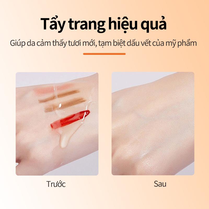 Sữa Rửa Mặt Vitamin C Niacinamide, Kangyan, Làm Trắng Và Trẻ Hóa Da, Thu Nhỏ Lỗ Chân Lông, Làm Sạch Sâu, Nuôi Dưỡng, Unisex 3