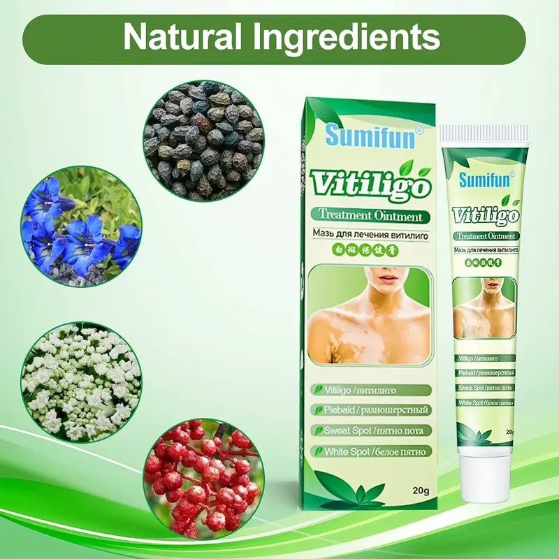 Obat Penghilang Vitiligo Salep Krim Vitiligo Kulit Bercak Belang Bintik Putih Paling Ampuh 20 gr Bebas Paraben 1