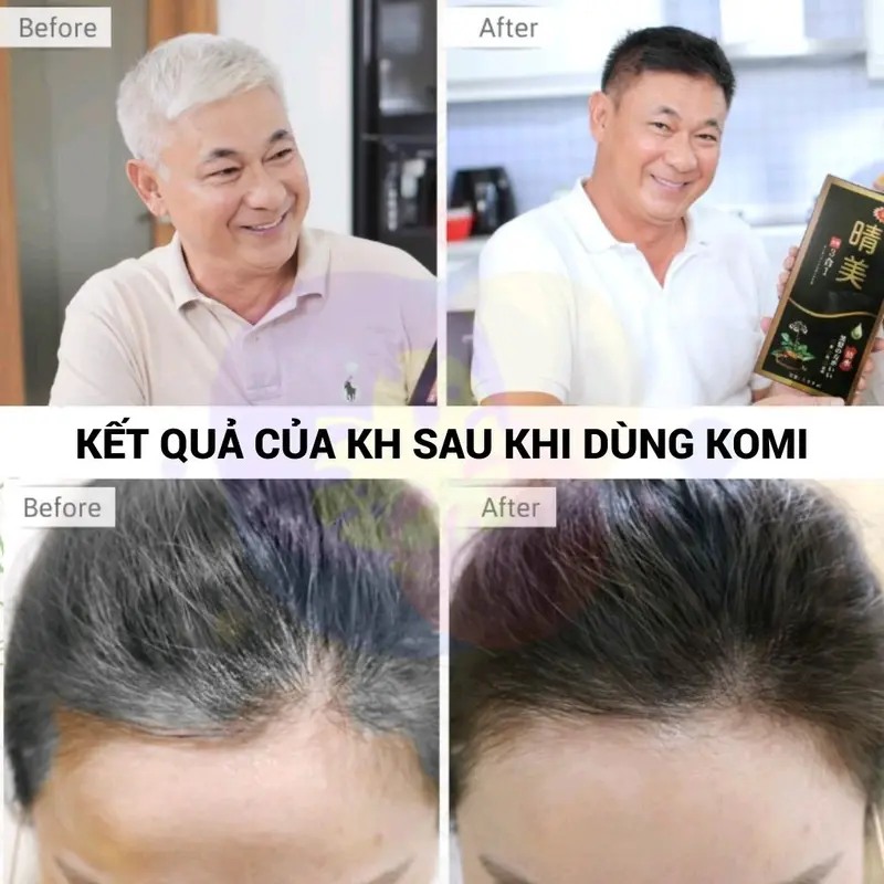 Dầu gội phủ bạc thảo dược Komi , dầu gội nhuộm tóc thảo dược Nhật Bản màu hộp 10 gói x 25ml 1