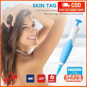 Alat Penghilang Kutil Skin Tag Mole Removal Kit 2 in 1 LGV41