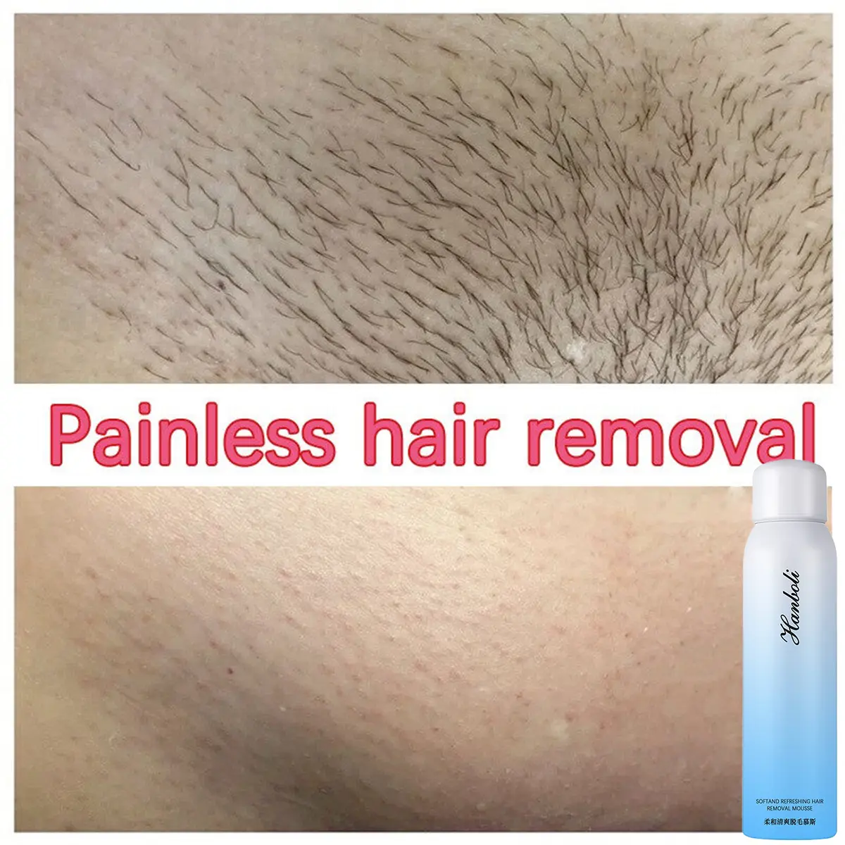 Xịt tẩy lông Kem tẩy lông Vùng kín Nách Chân Tẩy lông bikini Tẩy lông nhẹ nhàng an toàn và nhanh chóng 150ml