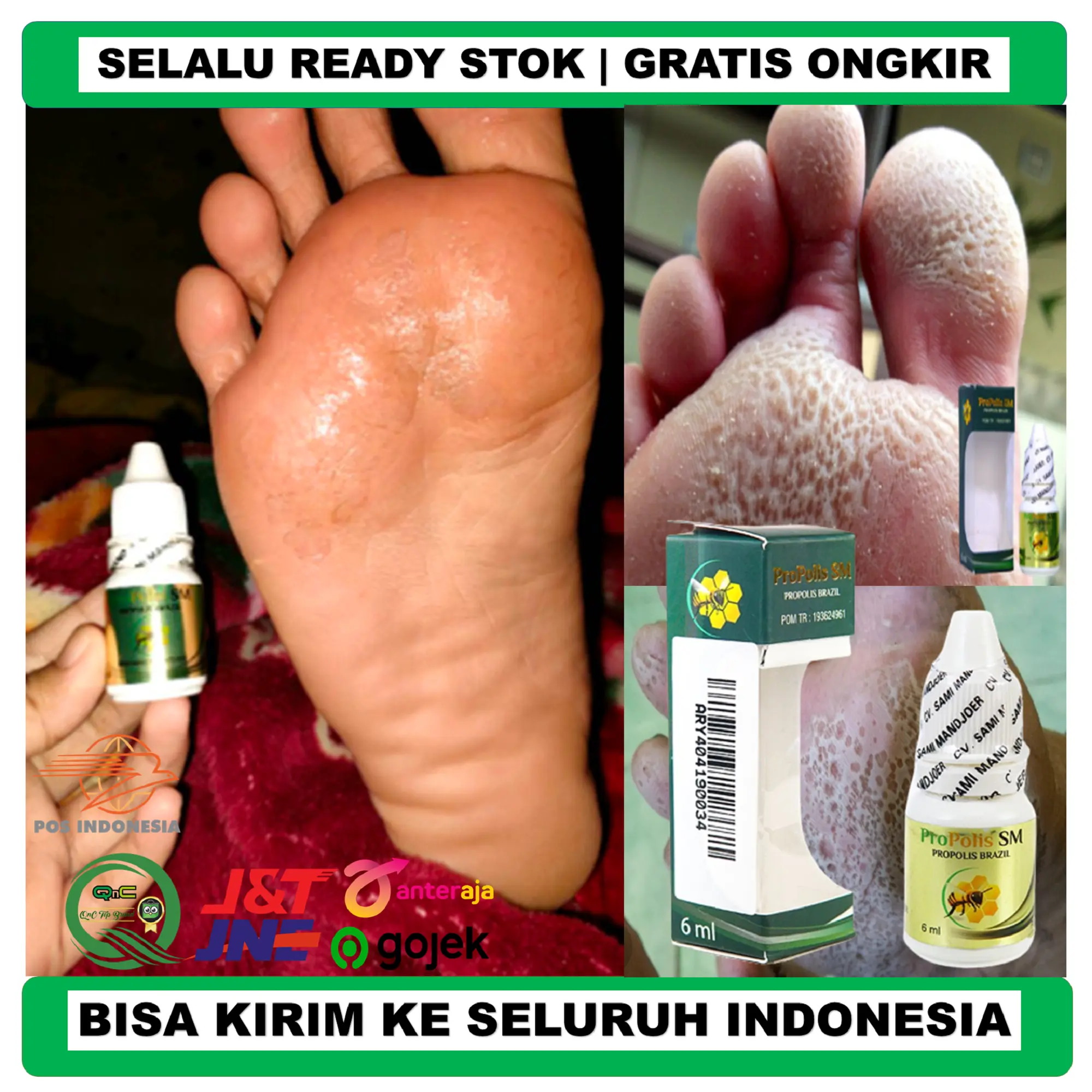 Propolis SM Untuk Kaki Rayapan dan Bau Isi 6 ml