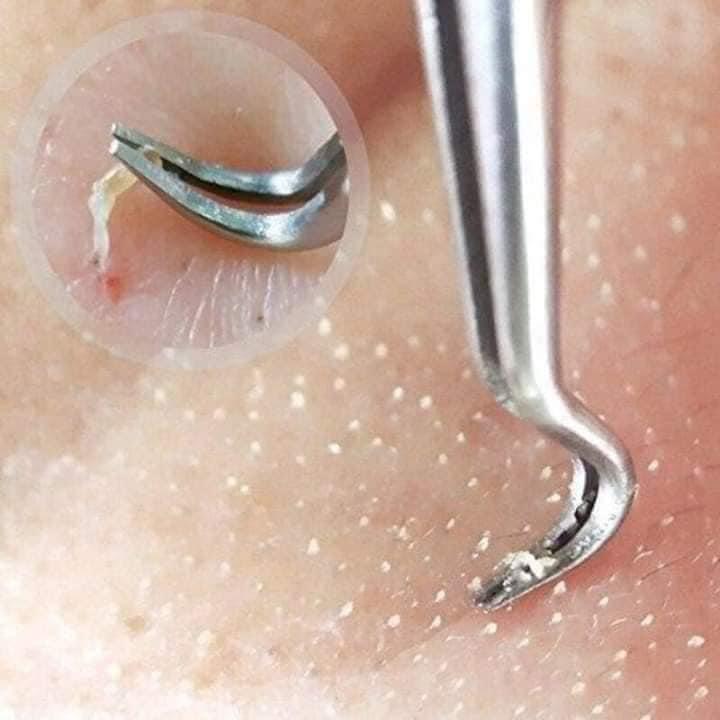 Nhíp Gắp Mụn Đầu Cong - Dùng Lấy Nhân Mụn