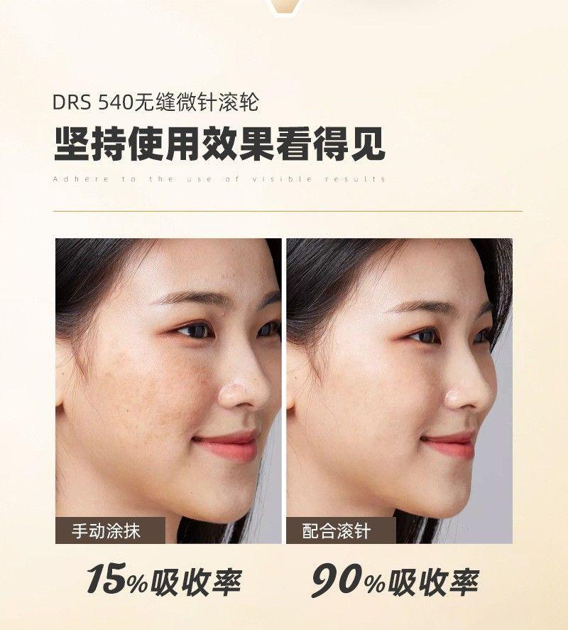 Product Introduction of Con Lăn Kim Y Tế, Con Lăn Kim Nhập Khẩu, Con Lăn Đầu Con Lăn Kim Siêu Nhỏ Thích Hợp Cho Thẩm Mỹ Viện Và Sử Dụng Cá Nhân, Để Tóc Mọc, Mặt Và Cơ Thể, 2024 6