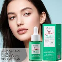 Gambar Kormesic 5in1 Intense Acne Solution Serum 30ml/Serum Wajah - 5in1 Serum, Kormesic dari Tokoserba serbu Kota Administrasi Jakarta Barat 2 Tokopedia