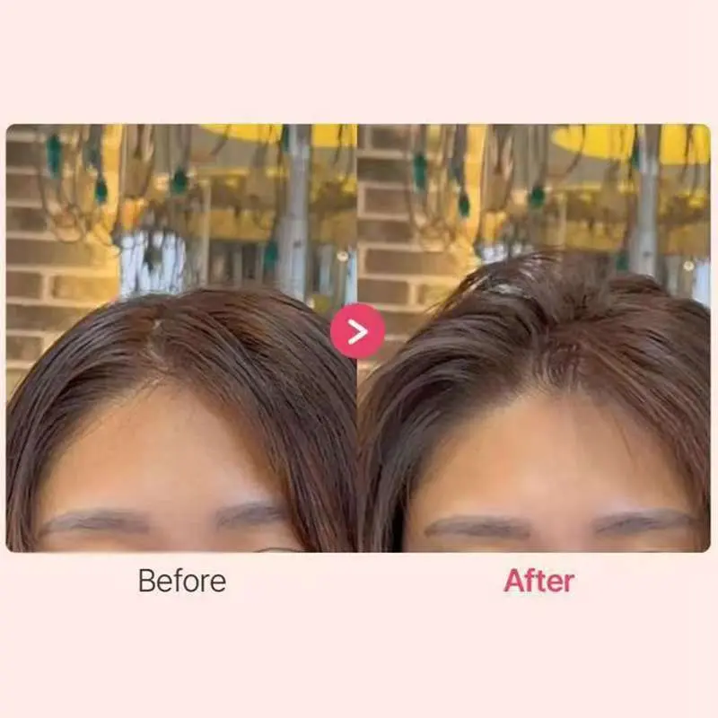 [Bán chạy] Lược Làm Phồng Chân Tóc, Kẹp Tạo Phồng Chân Tóc Mái Thời Trang Hàn Quốc 3 Răng - 6 Răng Cho Nam Nữ   Kẹp tóc đệm kiểu tóc gió phiên bản nâng cấp 2.0 5