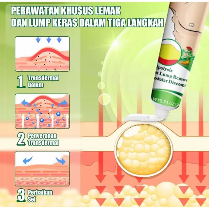 SOL LORA lipoma cream salep benjolan 100% Original Herbal Ampuh lipoma cream salep benjolan 7 days lipoma removal cream 2