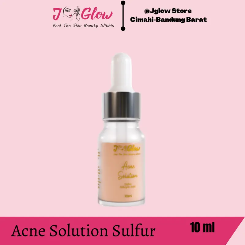 JGLOW TOTOL ACNE SALEP / TOTOL ACNE CAIR / TOTOL SALEP IRITASI Treatment Perawatan 1