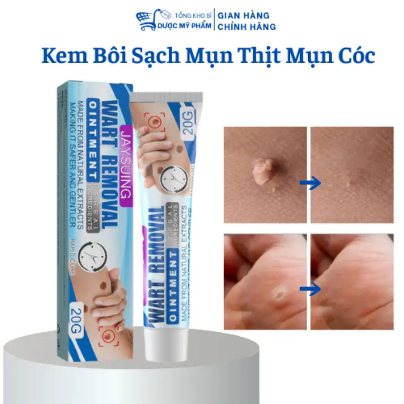 Kem bôI loại bỏ mụn thịt thừmụn cóc nốt ruồi li ti quanh mắt thành phần thảNữ Women Dưỡng Mắt Cho Bé
