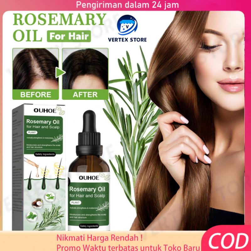 Rambut Penumbuh Rosemary Oil 50ml Rambut Botak Perawatan Rambut Rontok ...