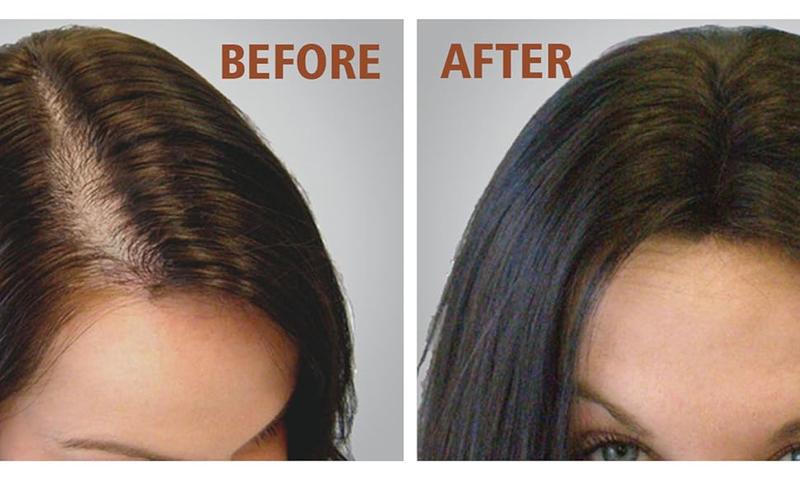 Product Introduction of Batana Oil for Hair Growth, 100% Raw Batana Oil for Hair Growth (1pcs) Haircare Comfort 2