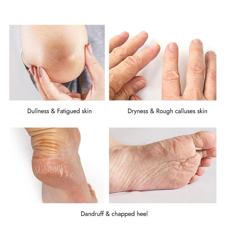 200g Paraffin Wax for Foot Care Hand Care, Foot Scrubber Wax for Calluses Removal, Exfoliating Foot Scrubber, Hard Skin Remover, Skin Care Products 5