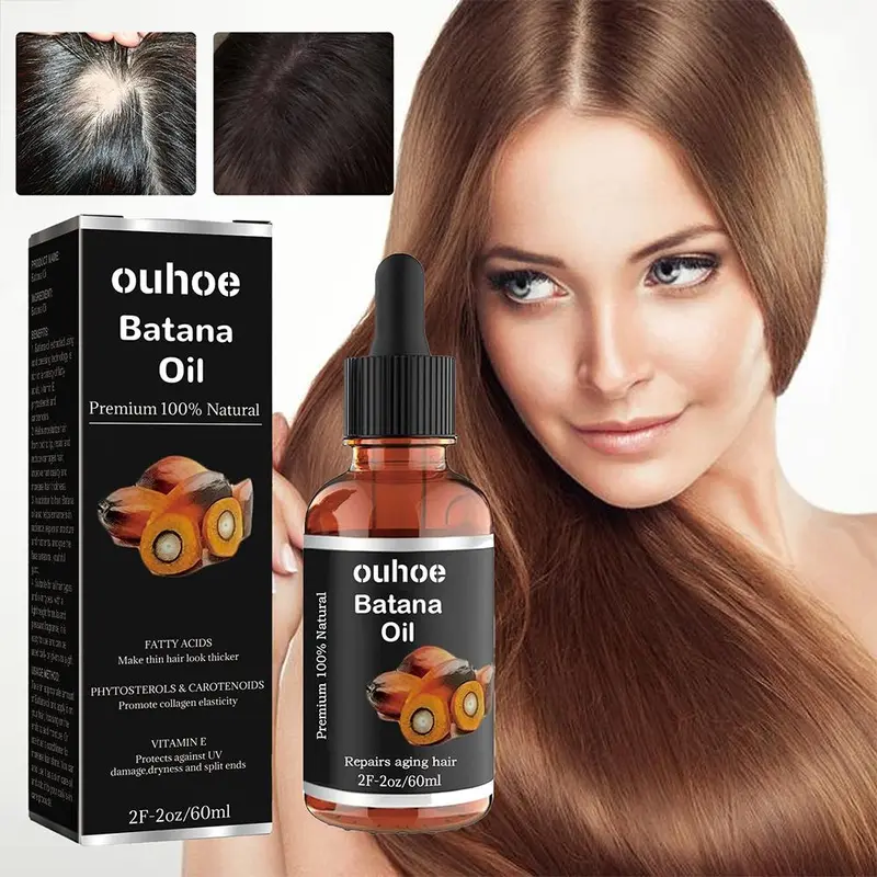 OUHOE Batana Oily Hair Essence 60ml Memperbaiki Rambut Rusak Memperkuat Akar Rambut Secara Efektif Mencegah Rambut Rontok Melembutkan, Menutrisi, Menenangkan Dan Memperbaiki Kulit Kepala Meningkatkan Kualitas Dan Kesehatan Rambut Esensi Perbaikan Rambut 1