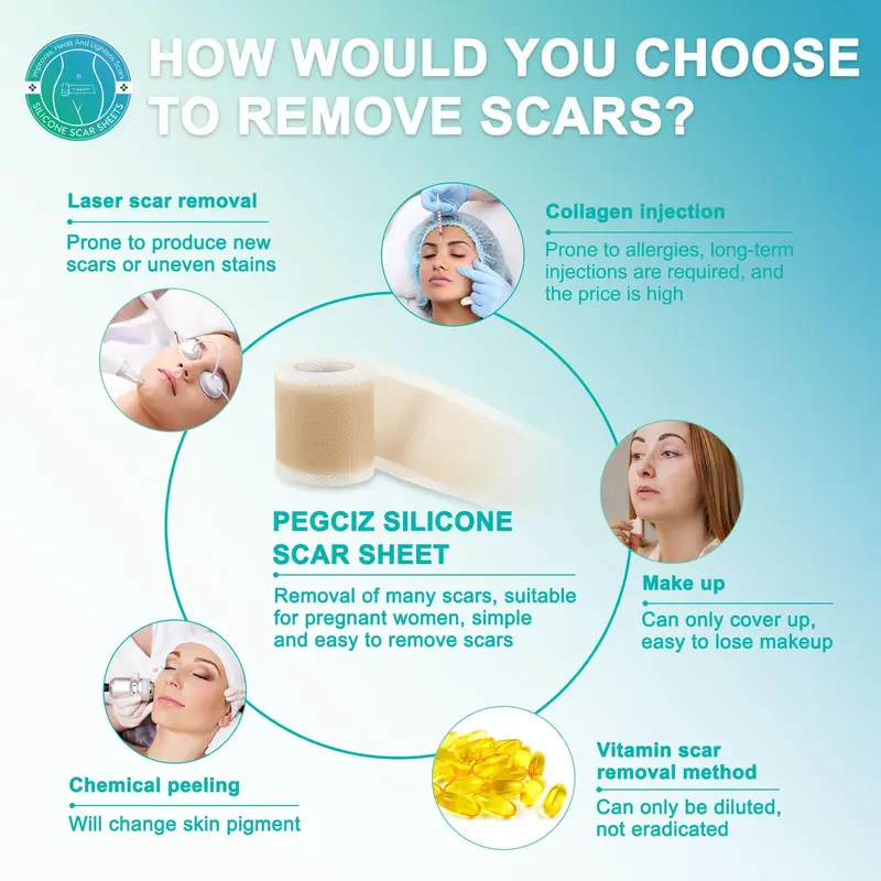 Silicone Scar Sheet, Reusable Scar Sheets, Professional Scar Removal Tool for C-section, Surgery, Burn, Keloid, Acne, Skincare Tools, Korean Skincare Products, Improves, Scar Gel 2