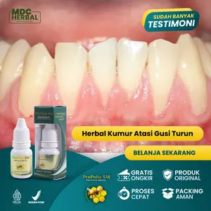 Cairan Gusi Turun, Gusi Bengkak Sakit, Herbal Kumur Untuk Gusi Turun Ke Bawah, Gusi Mengelupas dari Gigi, Gusi Turun Karena Behel Gigi, Bau Mulut Karang Gigi, Resesi Gusi, Gingival, Gusi Turun Pada Anak Alami, Propolis SM Brazil Herbal