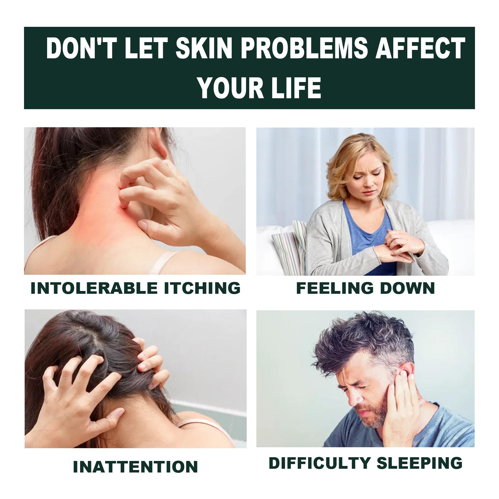 Salep Psoriasis Anti-Gatal Paling Efektif Salep Gatal Cina 0 Obat Gatal Selangkangan Paling Efektif Salep Eksim Kering 20g Salep Gatal Selangkangan 0 Obat Gatal Genital Obat Gatal Kulit Perbaikan Kulit Salep Psoriasis Anti-Gatal Paling Efektif Salep Gatal Cina 0 Obat Gatal Selangkangan Paling Efektif Salep Eksim Kering 20g Salep Gatal Selangkangan 0 Obat Gatal Genital Obat Gatal Kulit Perbaikan Kulit