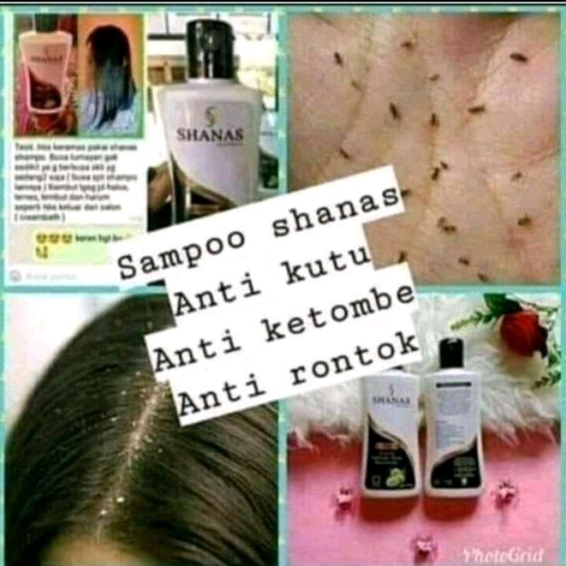 SHAMPO PEMANJANG RAMBUT//PENUMBUH RAMBUT SHANAS 2