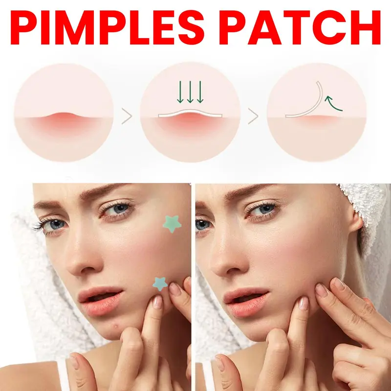 Star Shaped Acne Patches, 5 Sheets/box Hydrocolloid Acne Covering Patches, Facial Skin Care Products for Women & Men 6