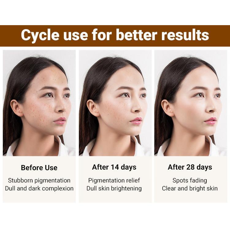 Được đề xuất bởi Centennial Medicine Whitening Spot Lightening Cream 3