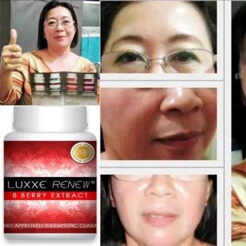 Luxxe White Renew Glutathione with Collagen Pure Barley Berry Extract Frontrow Supplement Edible Healthcare Cranberry Beauty Health Dietary Dietary Fitness - TikTok Shop Philippines Luxxe White Renew Glutathione with Collagen Pure Barley Berry Extract Frontrow Supplement Edible Healthcare Cranberry Beauty Health Dietary Dietary Fitness - TikTok Shop Philippines
