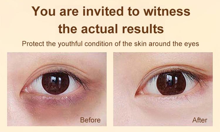 Dinkiss Eye Treatment Oil Improve Skin Radiance Reduce Wrinkles Relieve Puffiness