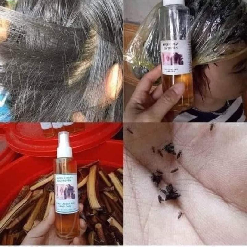 Ủ chấy siêu nhạy chỉ 1 lần là sạch chấy 0