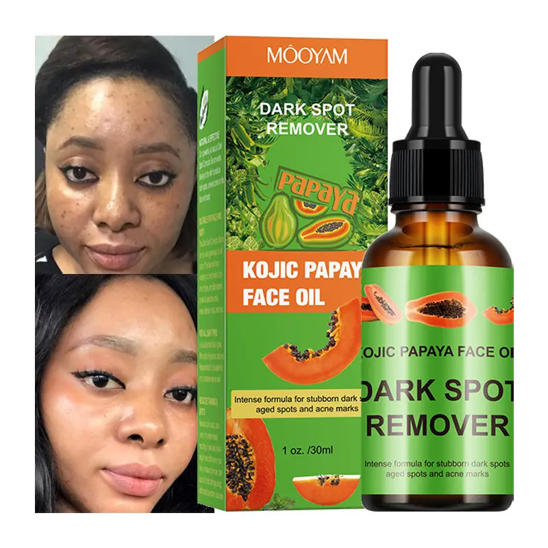 Cosmetics Papaya Kojic Acid Essence Nourishing Skin Care Fade Black Spot Brightening Kojic Acid Papaya Essence