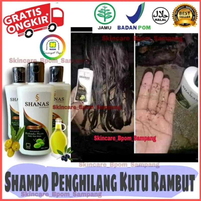 ANTI KUTU SHANAS SHAMPO Shampoo