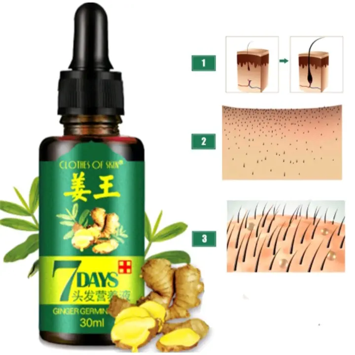 ️️BIG SALE️ ️ORI [PENUMBUH RAMBUT BOTAK] Essence Anti Rontok / Botak Asli Obat Uban Penghitam Penyubur Original 3