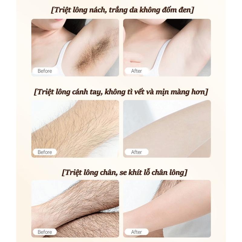Kem tẩy lông SADOER , tẩy lông vùng kín, nách, tay, chân, triệt lông an toàn không đau rát dung tích 150ml ZYC11CSD1C 7