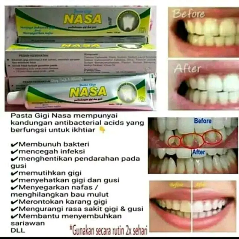 Pasta Gigi Nasa PGN Ekstrak Cengkeh Memutihkan & Merontokkan Karang Gigi - Gusi odol gigi sensitif 3
