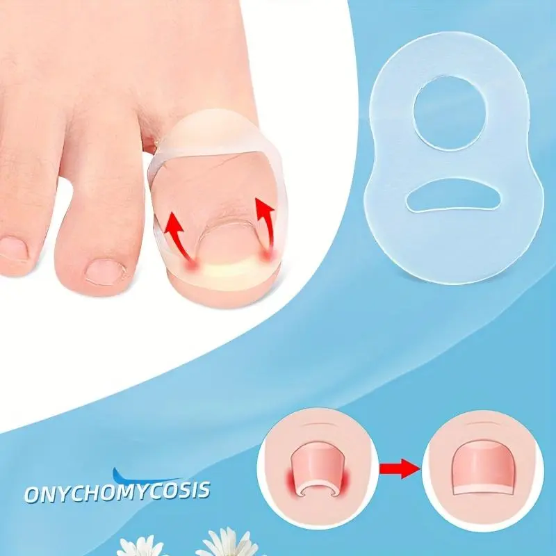 Soft Silicone Nail Groove Corrector, 2 Counts Comfortable Nail Corrector Suitable for All, Manicure & Pedicure Tools for Home & Salon Use 2