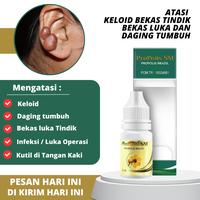 Gambar Penghilang bekas tindik di telinga, Penghilang daging tumbuh,Penghilang Bekas Luka Di tangan dan kaki dari Healthy Best Kota Administrasi Jakarta Barat 1 Tokopedia