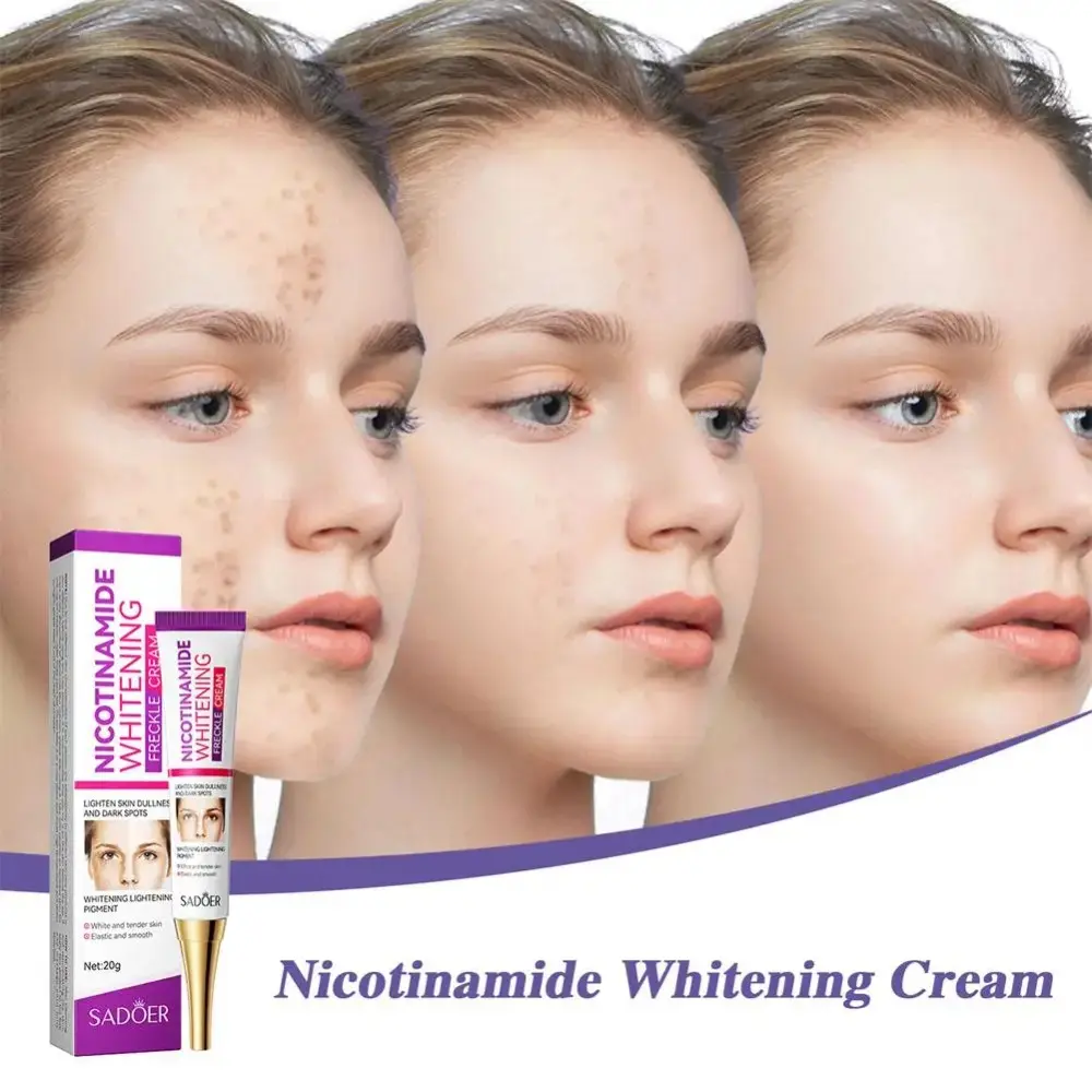 Effective Nicotinamide Whitening Cream Brightening Remove Melasma Freckles Cream Fade Color Spots Skin Hydration Moisturize Cream Face Skin