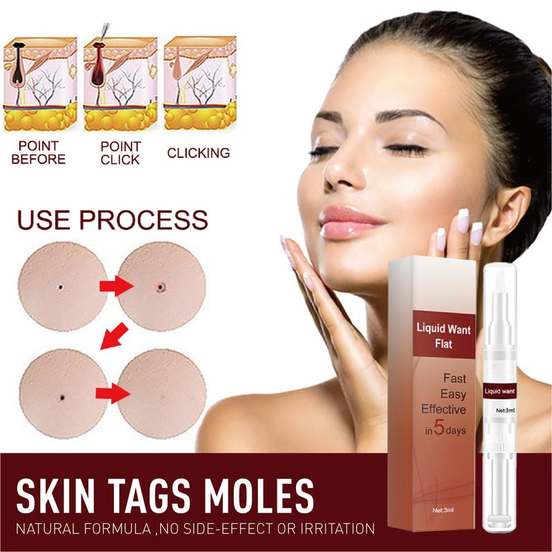 Product Introduction of Warts Remover Cream Original Watson Warts Removal Mole Remover Organic Cream Skin Tags and Warts Remover Original 5