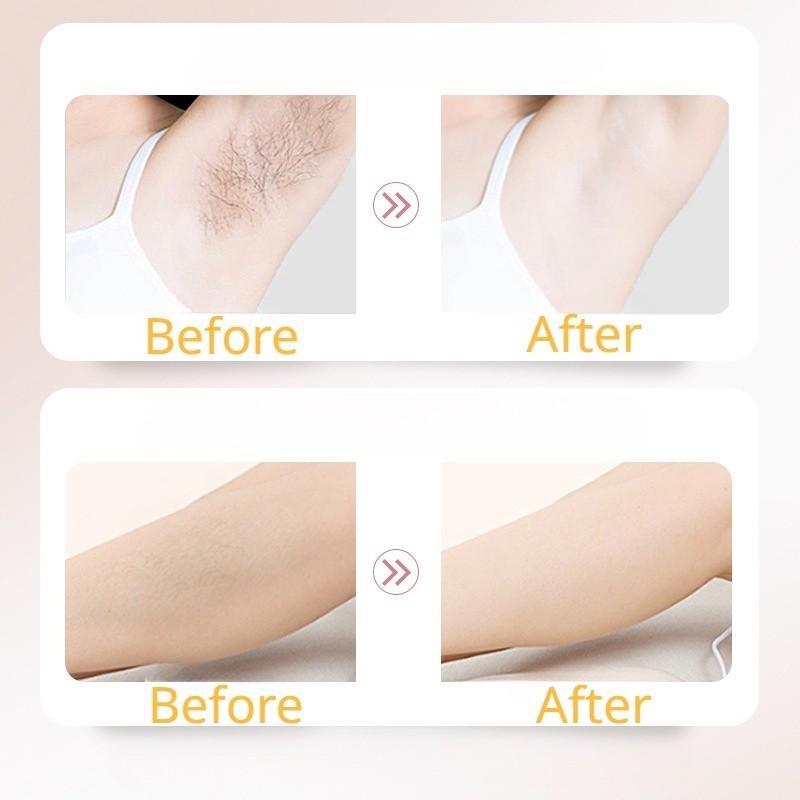 Product Introduction of HANKEY Hair Removal Cream Gentle Skin Painless Hair Remover Armpit Legs Arms Skin Care Body Care Depilatory Cream 26