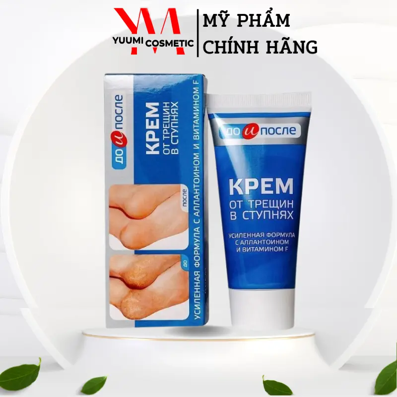 Kem Nứt Nẻ Gót Chân Kpem Nga 50ml Giúp Giảm Nẻ Chân,Tái Tạo Và Phục Hồi Da Gót Chân Hiệu Quả Nữ Women Cosmetic