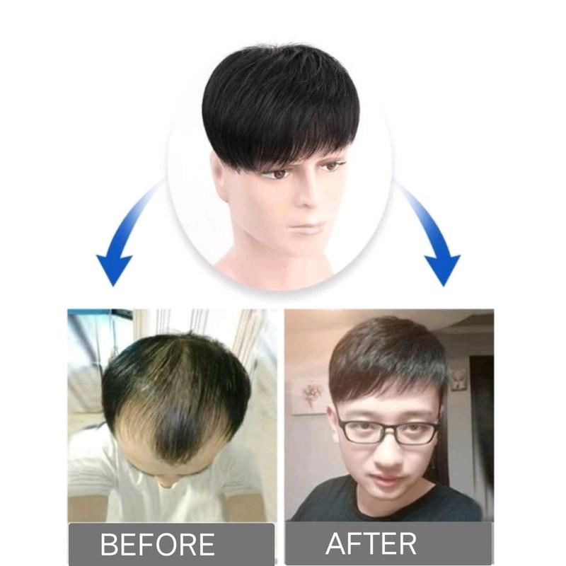 COD-Toupee Pria Rambut Pendek Warna Hitam Penutup Botak Pria Rambut Pendek Hitam Natural 5