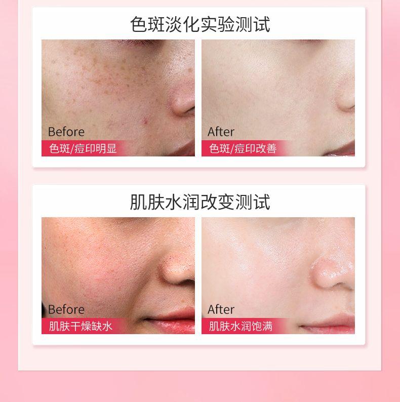 Product Introduction of Topeng pemutih dan penyingkiran jeragat Ohbt, melembapkan dan mencerahkan tona kulit, perubahan warna, peningkatan bintik pucat, nicotinamide, anti-oksigen, anti-gula wanita 7