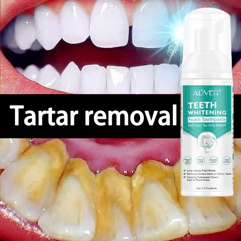 ALIVER Teeth whitening mousse toothpaste Remove Tartar Remove Plaqu Oral Odor Bright Teeth Brush Foam Antibacterial Foaming Repair