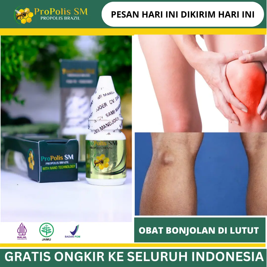 Suplemen Penghilang Benjolan Di Lutut, Benjolan Sakit Di Belakang Lutut, Benjolan Berisi Cairan Di Belakang Lutut, Tonjolan Kista Pada Persendian Tulang Lutut, Benjolan Ganglion di Pergelangan Tangan & Kaki Dengan Propolis Sm