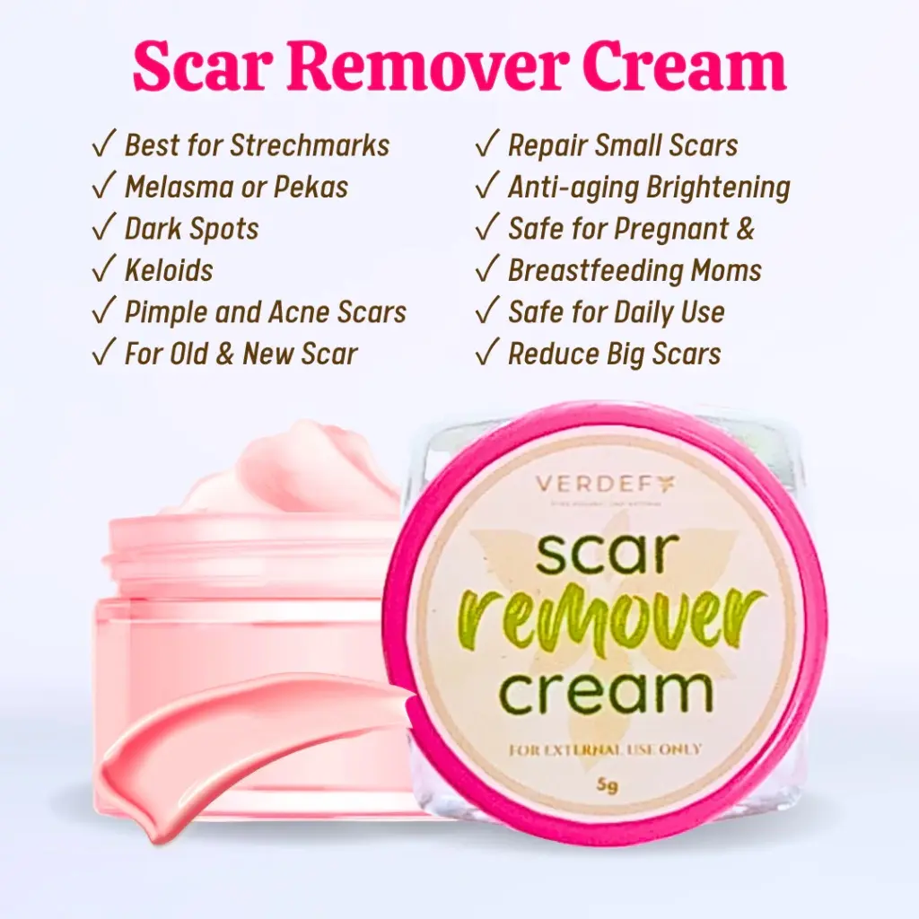 Keloid & Stretch Mark remover cream scar remover cream miracle cream Peclat cream by verdefy