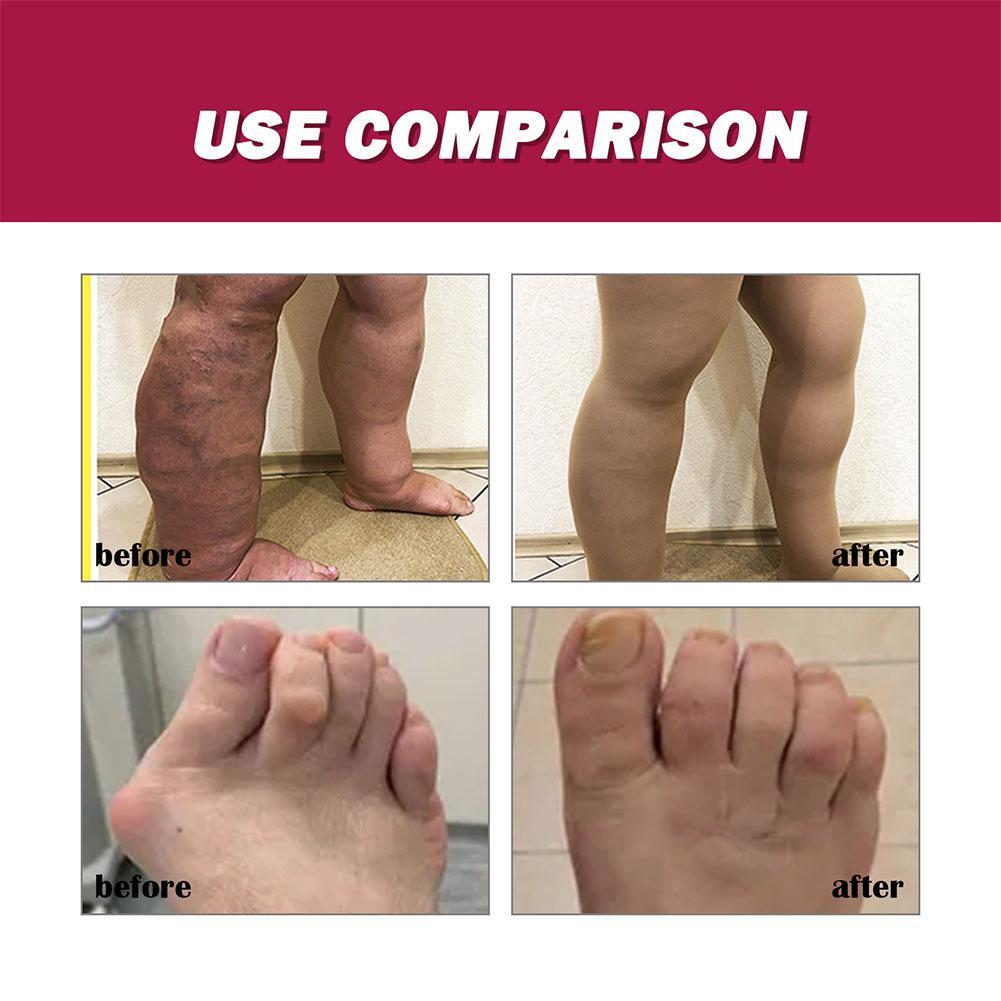 South Moon Joint Bone Therapy Intensive Concentrate Dan Pengobatan Terapi Sendi Krim Pereda Y9R3